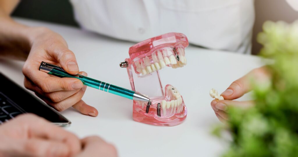 Dentist pointing to model of dental implant