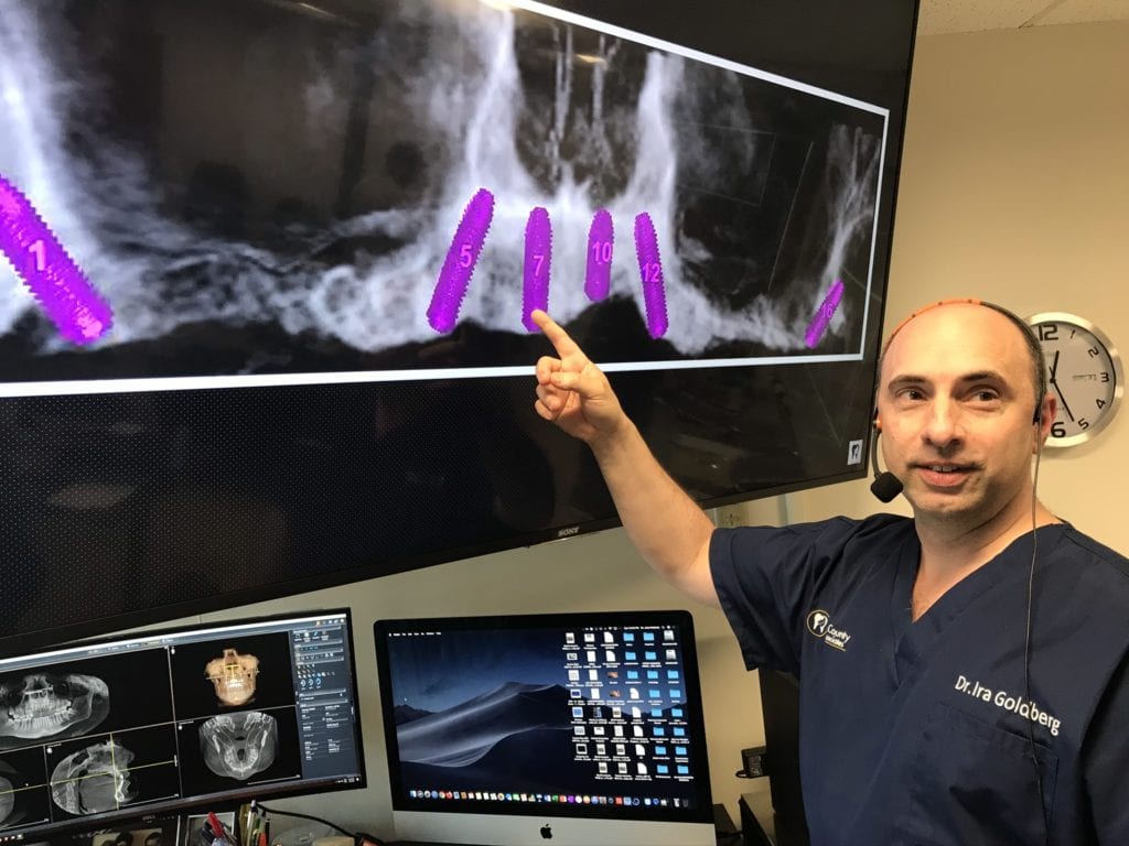 Dental Implants in Dr. Ira Goldberg