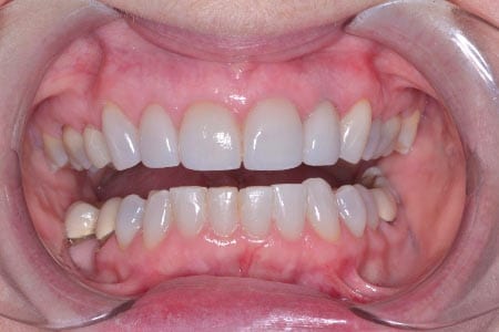 After dentistry at Morris County Dental Associates, LLC
