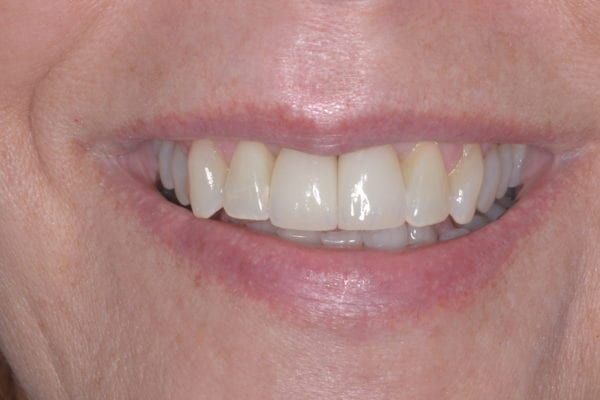 After dentistry at Morris County Dental Associates, LLC